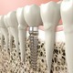 Зубные имплантаты Alpha Bio